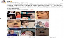 《针》在线观看,揭秘现代都市中的悬疑与人性较量