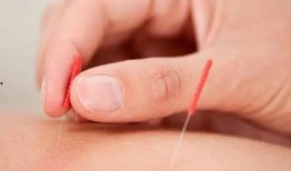 《针》在线观看,揭秘现代都市中的悬疑与人性较量